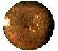 retina-macular.jpg (2527 bytes)