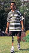 One of the many who have benefitted from TAL's artificial limbs 