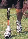 A TAL prosthetic device
