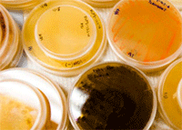 Marine samples being readied for study in the laboratory of William Fenical. 