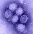 Swine flu fear grips B’lore as 2 SAP employees test H1N1 positive