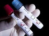 India tops Asia-Pacific in new AIDS infections: UN