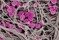 Researchers develop reversible anti-platelet therapy to fight clotting, cancer metastasis