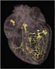 Rhythm of heart revealed by 3D X-ray