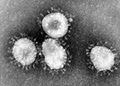 SARS-CoV-2 virus can only be traced to China’s Wuhan lab: study