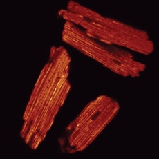 Cause of organ damage after heart attack and stroke found