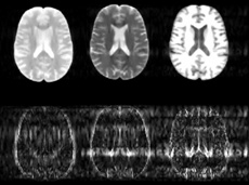 Visual Image Algorithm Mri New algorithm could substantially speed up MRI scans | Domain-b.com